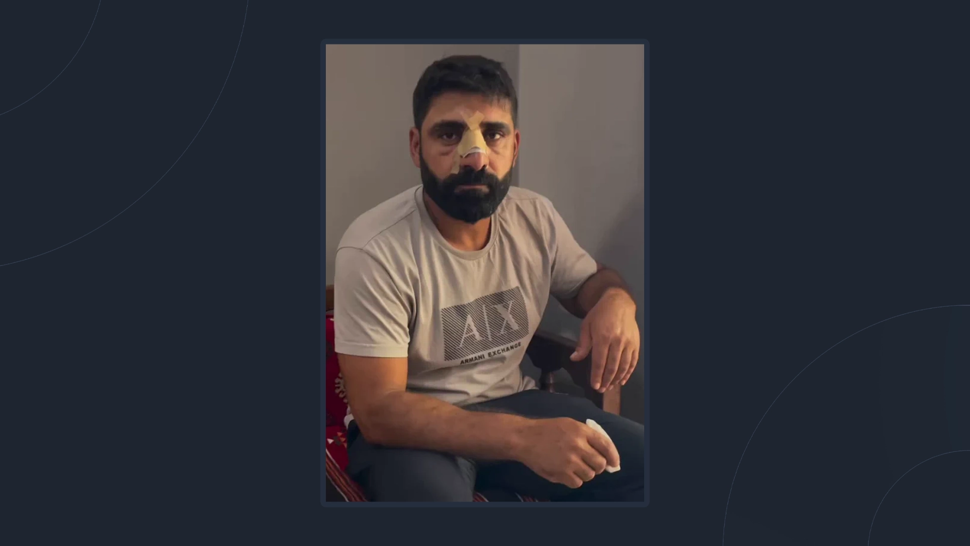 LI BAYBURTÊ JÎ LI DIJÎ FORMAYA AMEDSPORÊ ÊRIŞA NIJADPERESTÎ PÊK HAT